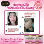 สบู่คอลลาเจนเข้มข้น (Collagen Stemcell Soap)